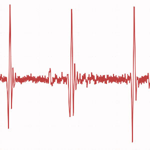 Harry's Heart Condition | Hatton James Legal